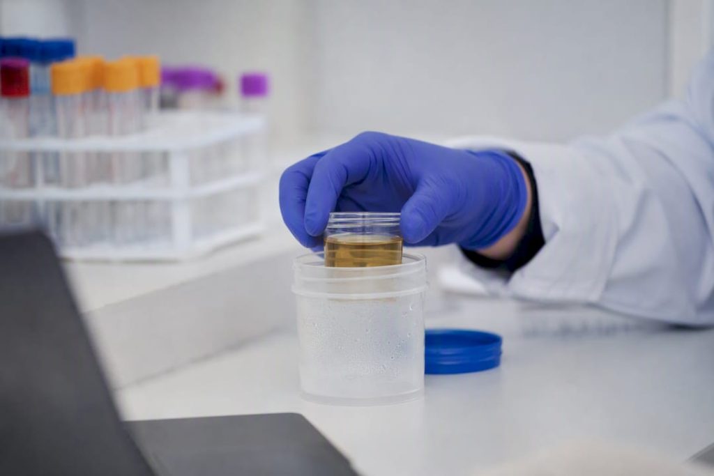 Psilocybin Drug Test: Detection Windows and Likelihood